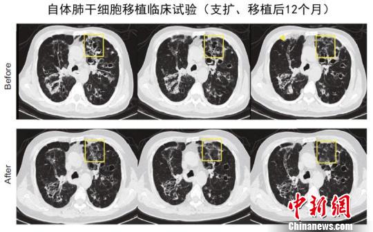 點(diǎn)擊進(jìn)入下一頁