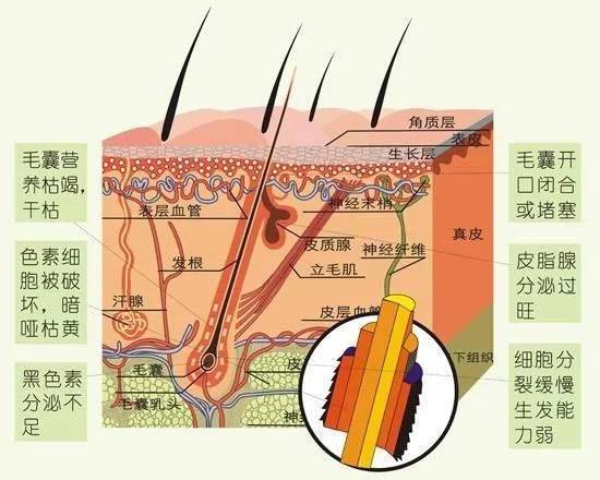 夏季是脫發(fā)高峰期 教你科學(xué)預(yù)防不掉發(fā)