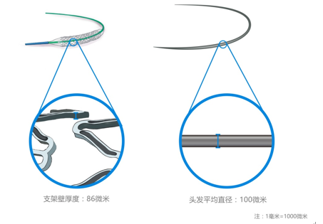 “火鷹支架”壁的凹槽與頭發(fā)直徑對(duì)比圖