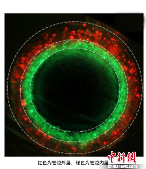 中美醫(yī)學(xué)專家攜手取得3D生物打印新進展